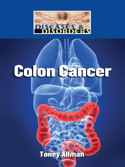 Title details for Colon Cancer by Toney Allman - Available